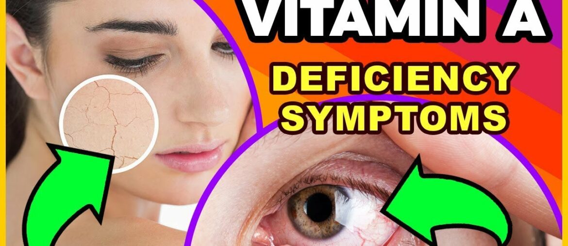 Vitamin A deficiency - Skin, Immunity & Eyes Problems (Symptoms & Food) in HINDI