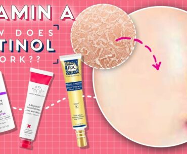 How to Use Vitamin A (Retinol, Retinoids & Retin-A) In Your Skincare Routine For Clear Skin
