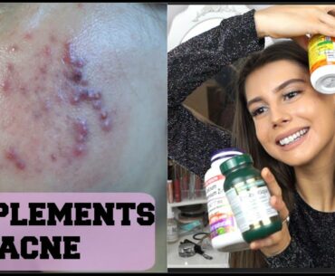 SUPPLEMENTS I TAKE FOR FLAWLESS SKIN AND ACNE|| Vitamin D, Zinc, Probiotics, Charcoal and more!