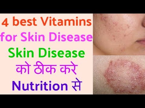 Skin Disease को ठीक करे Nutrition से | 4 best vitamin for skin disease Hindi