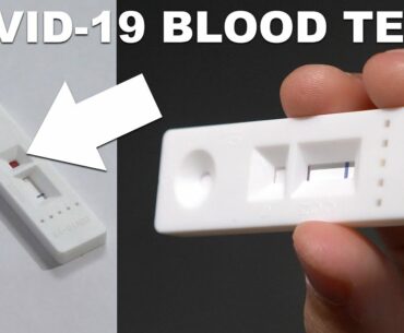 I Take The New Covid 19 Antibody Blood Test: 4.14.2020