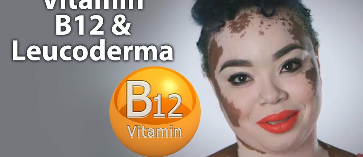 Vitamin B12 & White Patches/Leucoderma