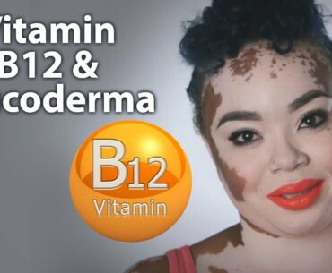 Vitamin B12 & White Patches/Leucoderma