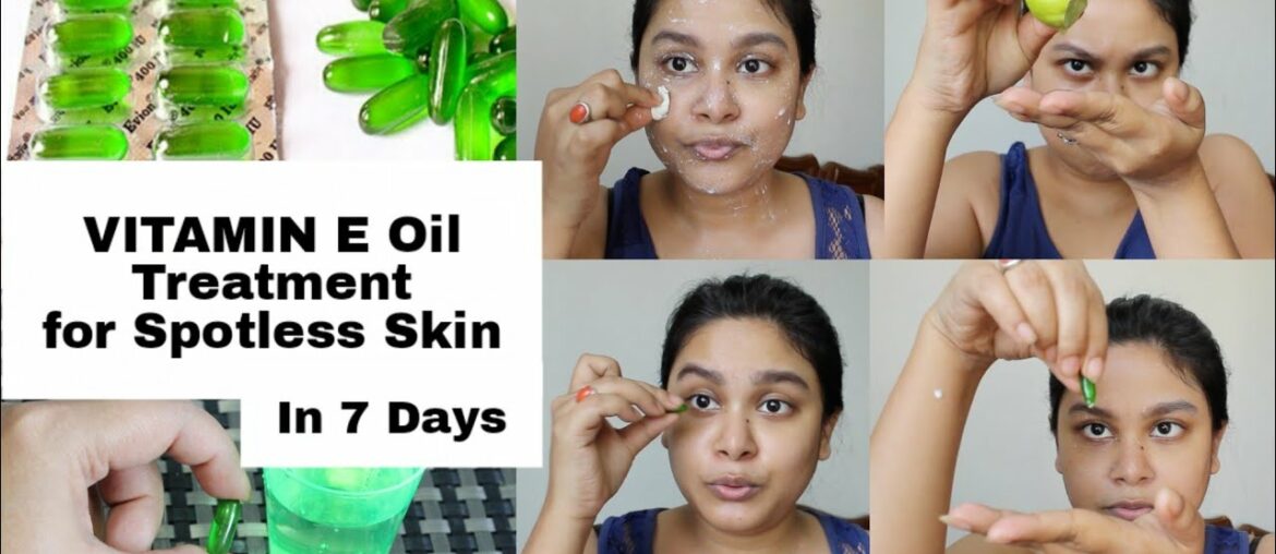 Vitamin E Oil Treatment For #Spotless Glowing #Skin विटामिन E कैप्सूल्स #Skincare #Beauty #VitaminE