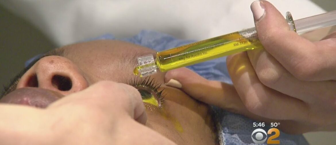Vitamin B Eye Drops Could Treat Serious Eye Condition