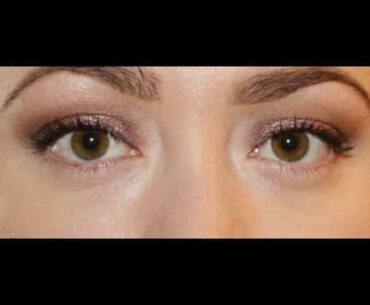 How to Remove Dark Circles Using Vitamin E Capsule I Simply Beauty Guide