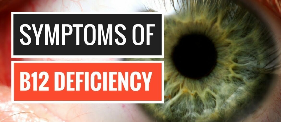 5 Signs and Symptoms of Vitamin B12 Deficiency