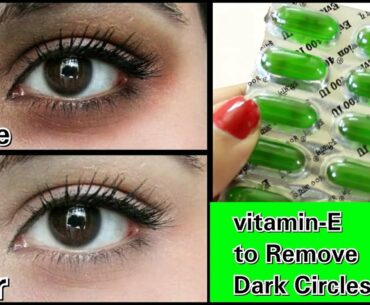 Remove Dark Circles in 3 days with Vitamin- E (100% Works)