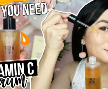 AMAZING SERUM! | BENEFITS OF VITAMIN C SERUM TO ACNE PRONE SKIN