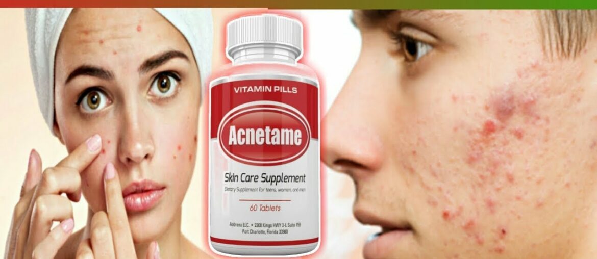 Acnetame- Vitamin Supplements for Acne Treatment, 60 Natural Pills