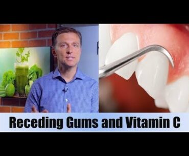 Receding Gums & Vitamin C