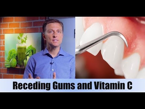 Receding Gums & Vitamin C