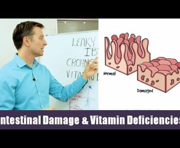 Intestinal Damage & Vitamin Deficiencies