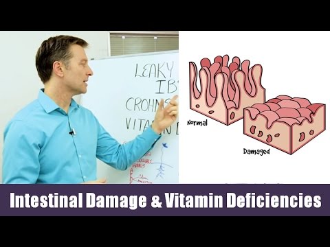 Intestinal Damage & Vitamin Deficiencies