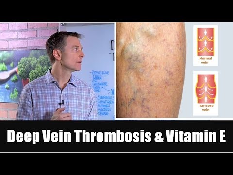 Deep Vein Thrombosis (Blood Clot in Legs) & Vitamin E
