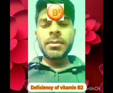 Deficiency of vitamin b2 vitamin b2 ki deficiency se kaun kaun se symptoms hamari body mein