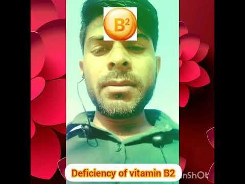 Deficiency of vitamin b2 vitamin b2 ki deficiency se kaun kaun se symptoms hamari body mein