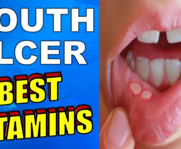 What is the BEST VITAMIN for MOUTH ULCERS