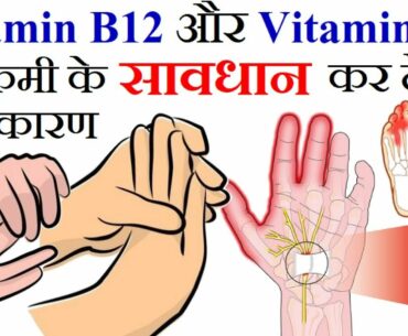 Vitamin B12 और D3 की कमी के चौकान देने वाले कारण | Numbness in Arms, Hands and Feet Reason in Hindi