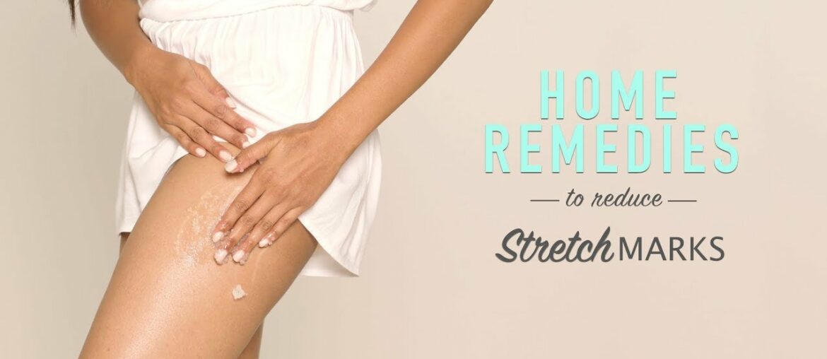 How To Reduce Stretch Marks | DIY Home Remedies