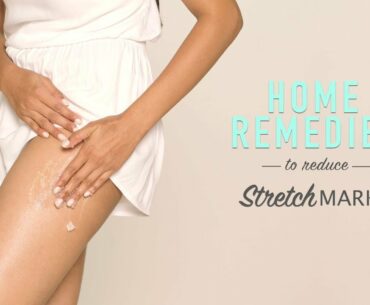 How To Reduce Stretch Marks | DIY Home Remedies