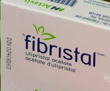 New fibroids drug treatment