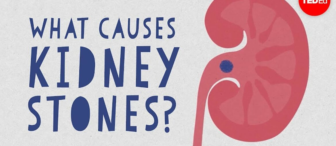 What causes kidney stones? - Arash Shadman