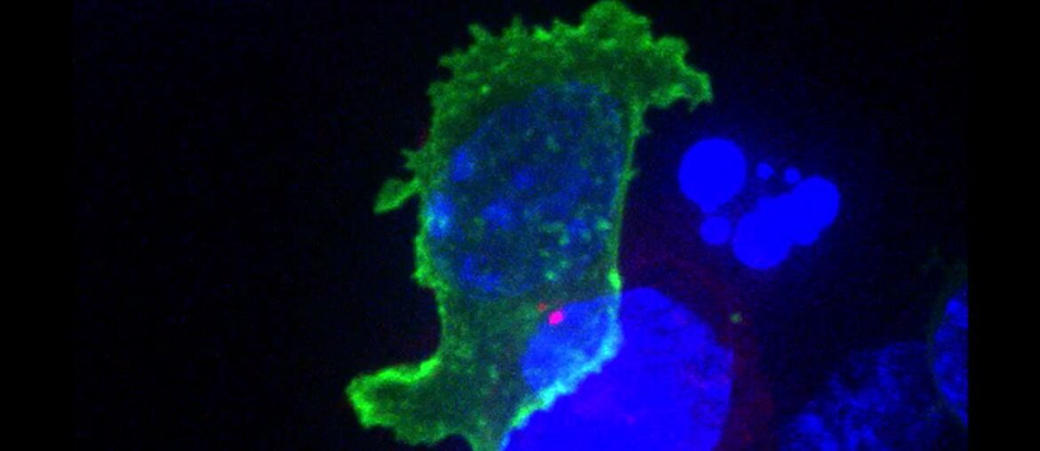 Killer T cell attacking cancer