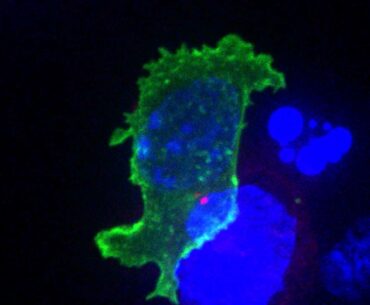 Killer T cell attacking cancer