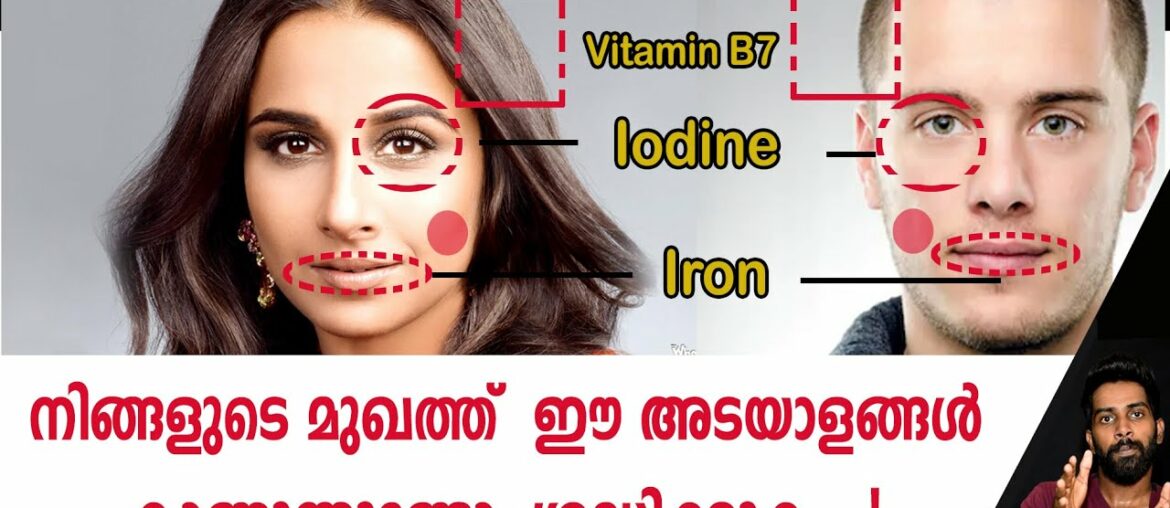 | ഈ അടയാളങ്ങൾ ശ്രദ്ധിക്കുക | Vitamin Deficiency |Certified Fitness Trainer Bibin