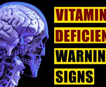 8 Symptoms Of Vitamin D Deficiency