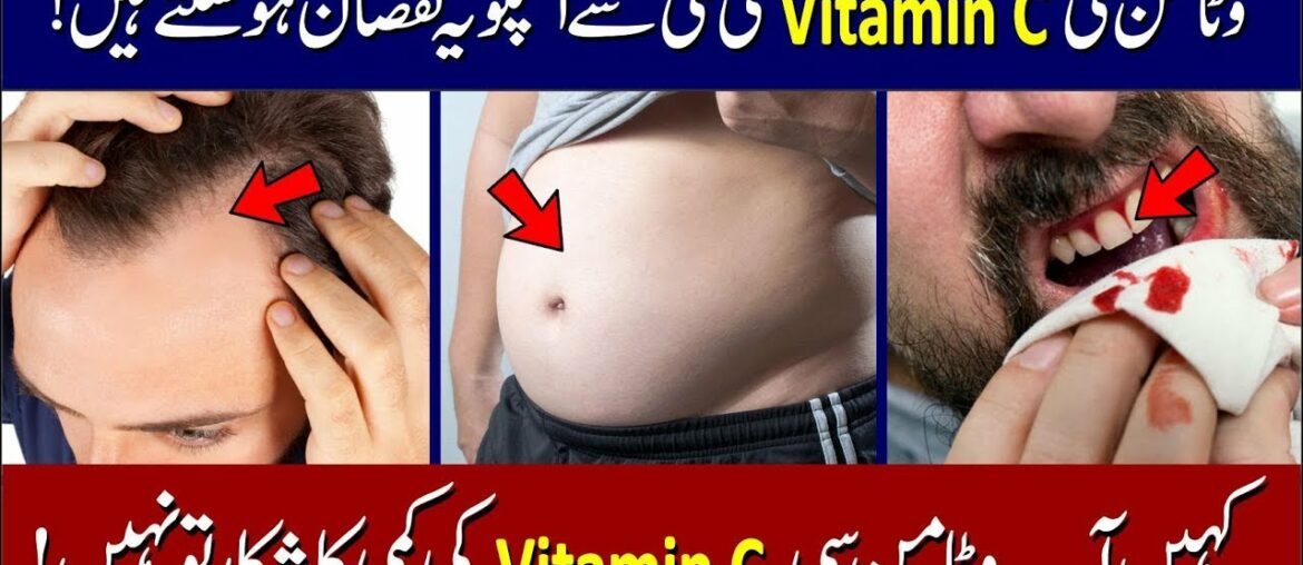 Vitamin C Benefits: Vitamin C Deficiency Symptoms in Urdu | وٹامن سی کی کمی کی علامات اور نقصان