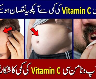 Vitamin C Benefits: Vitamin C Deficiency Symptoms in Urdu | وٹامن سی کی کمی کی علامات اور نقصان