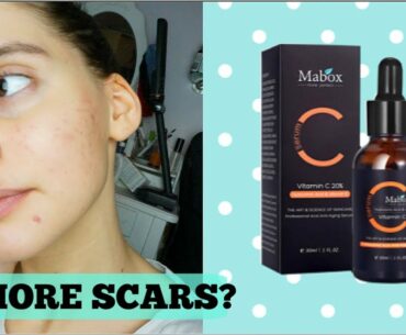 WHAT VITAMIN C DID TO MY ACNE SCARS || Acne Scarring 101