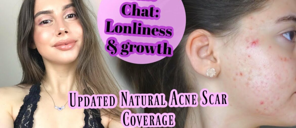 MY UPDATED EVERYDAY NATURAL MAKEUP ACNE SCAR COVERAGE ROUTINE! || Cover Hyperpigmentation, Spots!