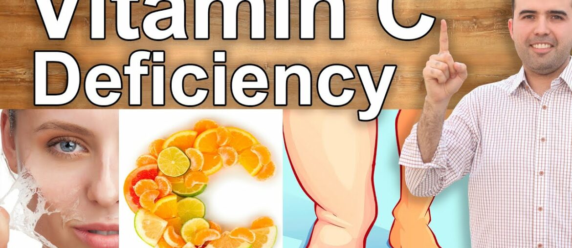 YOUR BODY IS SCREAMING IN NEED FOR VITAMIN C - Vitamin C Deficiency Symptoms and Its Benefits