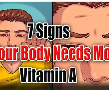 7 Signs Your Body Needs More Vitamin A || Easy Health Tips || Dr.Sheen