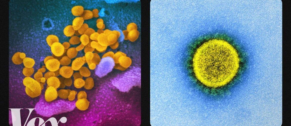 What the coronavirus looks like up close