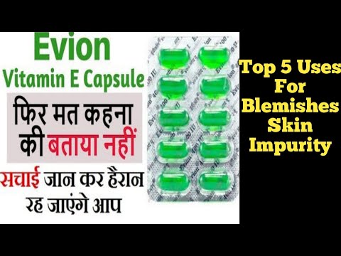 Top 5 Uses of Vitamin E Capsule for Pigmentation, blackspots, झाइयां hair growth..विटामिन E