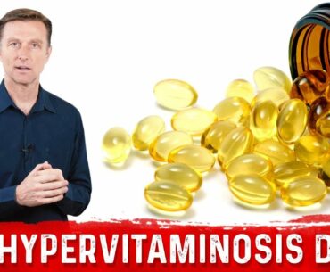 How to Reduce the Toxic Effects of High Amounts of Vitamin D