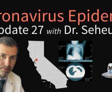 Coronavirus Epidemic Update 27: Testing accuracy for COVID-19 (CT Scan vs. RT-PCR), California Cases