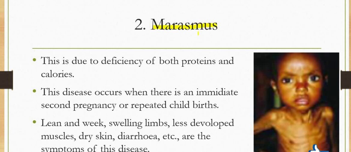 18 Health aspects of the alimentary canal, Reverse peristaltic, mal nutrition