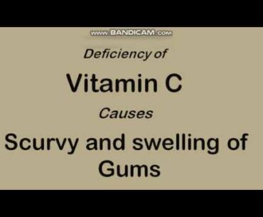 Diseases names due to vitamin deficiency