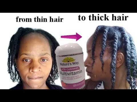 You need to try Nature's way Adult Vita gummies multivatimin. Hair vitamins for thickness