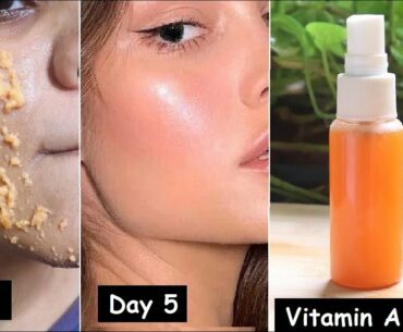 Apply Vitamin A toner/Serum for 5 Days to Boost Collagen, GLASS SKIN, Remove Wrinkles,Skin Whitening