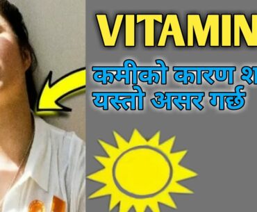 जानुहोस् Vitamin D को कमी भयो भने के हुन्छ??र के खाने त??What happen if Vitamin D Deficiency??