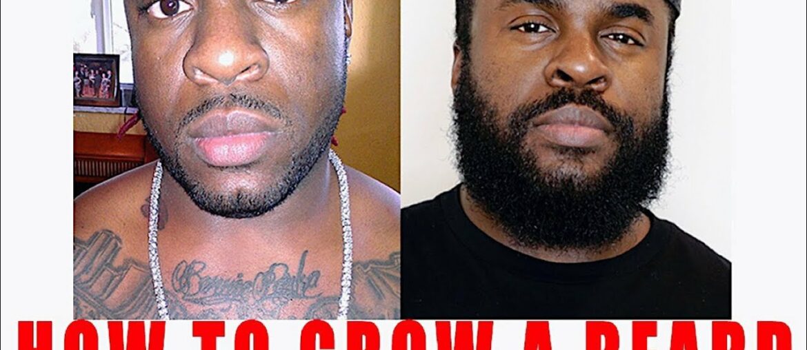 How To Grow A Beard | Does Minoxidil Work For Beard Growth | Minoxidil Beard Transformation