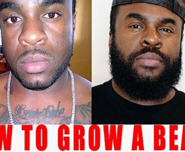 How To Grow A Beard | Does Minoxidil Work For Beard Growth | Minoxidil Beard Transformation