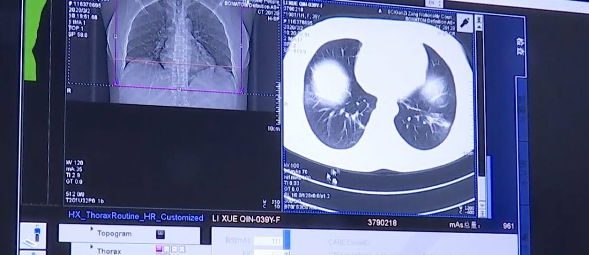 Applying 5G to remote CT scans on COVID-19 cases