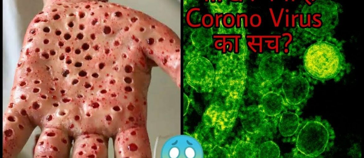 coronavirus kya hai, corona virus kaise hota hai, coronavirus se kaise bache